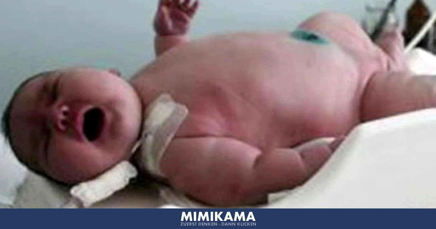 Faktencheck: 250 kg schwere Frau bringt 18 kg Baby auf die Welt!