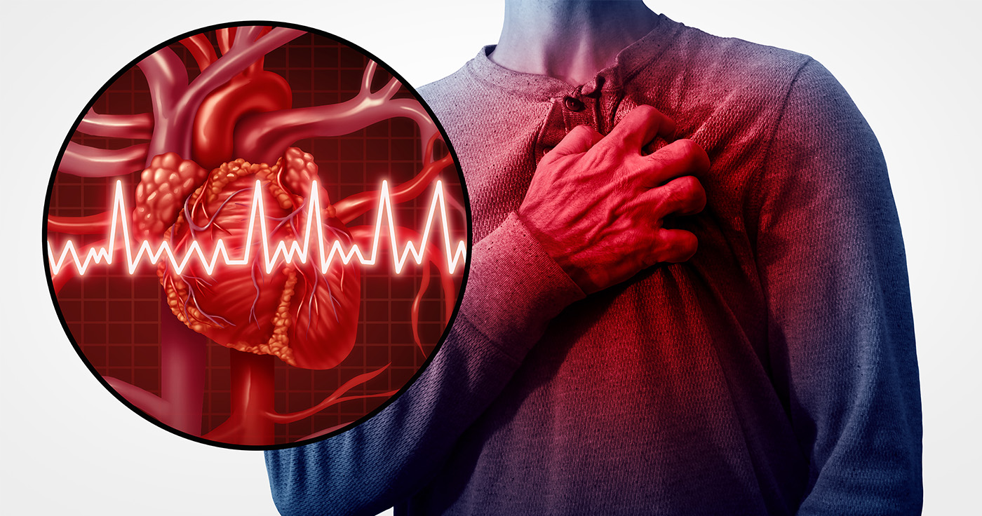 Was tun im Falle eines Herzinfarkts? / Artikelbild: Lightspring - Shutterstock.com