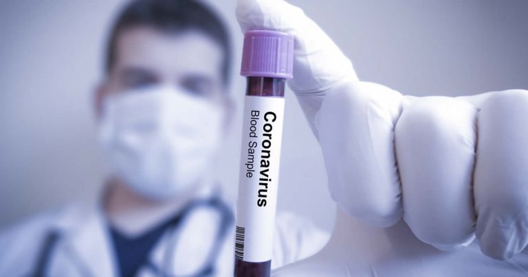 Coronavirus – Erster bestätigter Fall in Deutschland