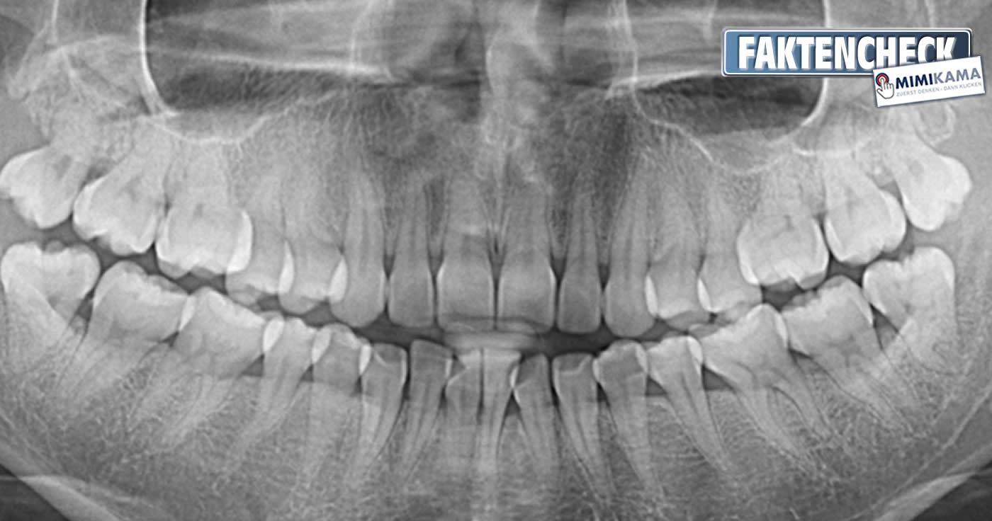 "Zähne wachsen in 9 Wochen nach" - der Faktencheck