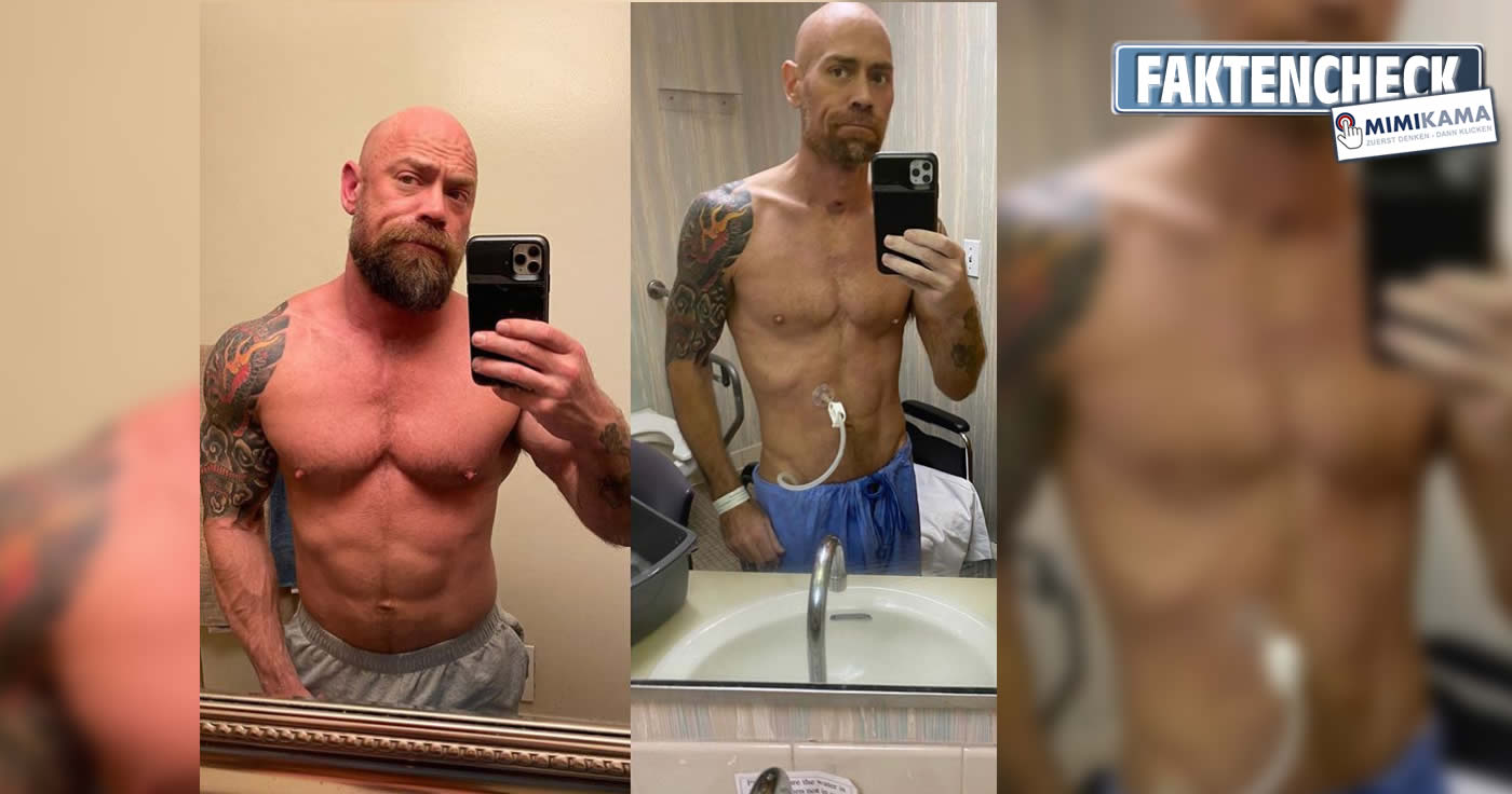 Mike Schultz verlor durch das Coronavirus 23 Kilogramm Gewicht in nur sechs Wochen