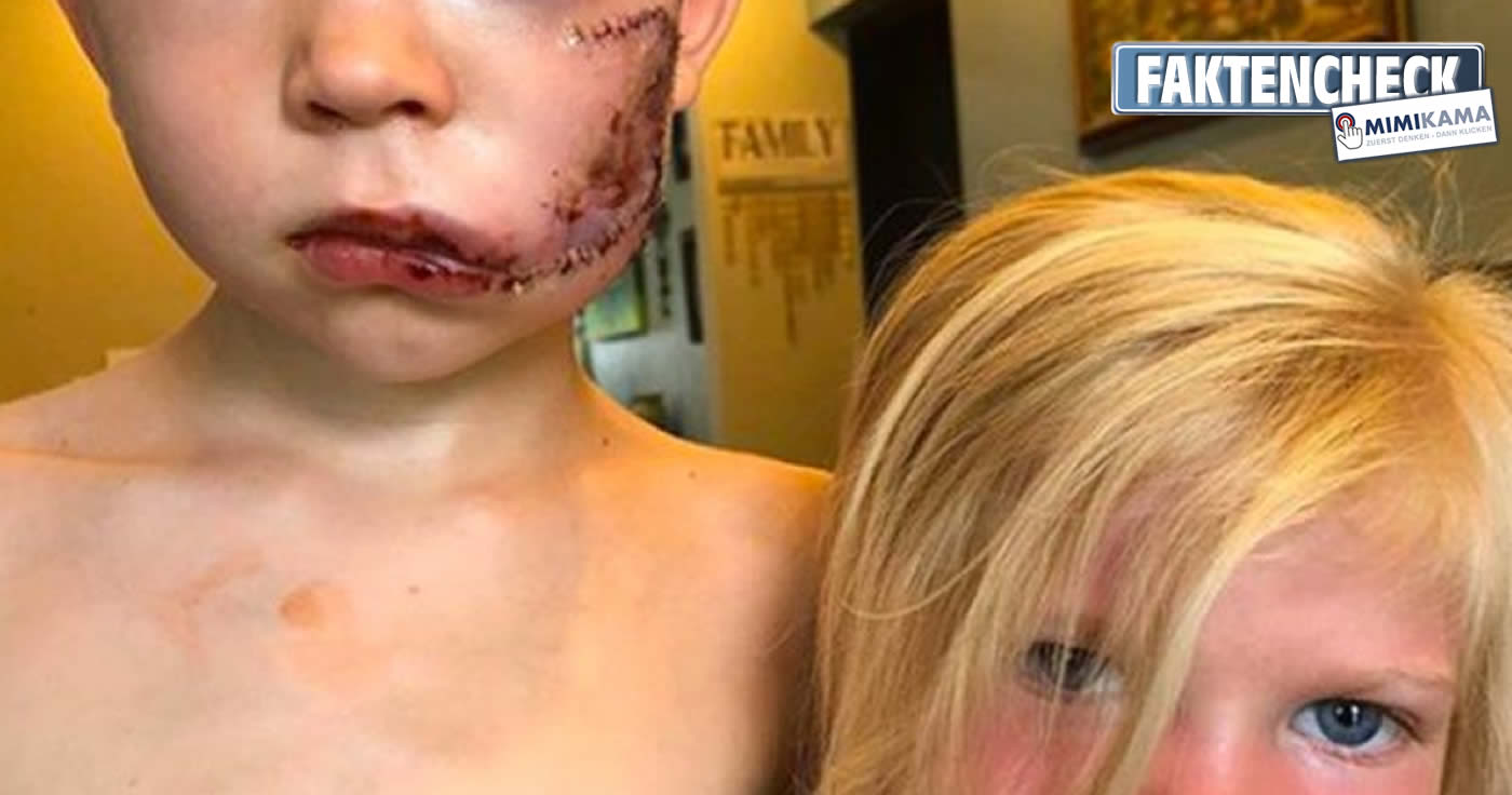 Kein Fake: Junge beschützte seine kleine Schwester vor einem Hund
