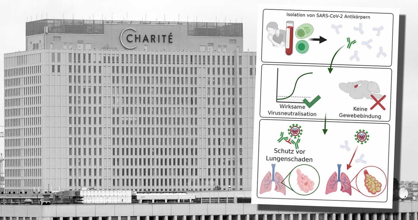 -Gemeinsame Pressemitteilung der Charité – Universitätsmedizin Berlin und des Deutschen Zentrums für Neurodegenerative Erkrankungen-