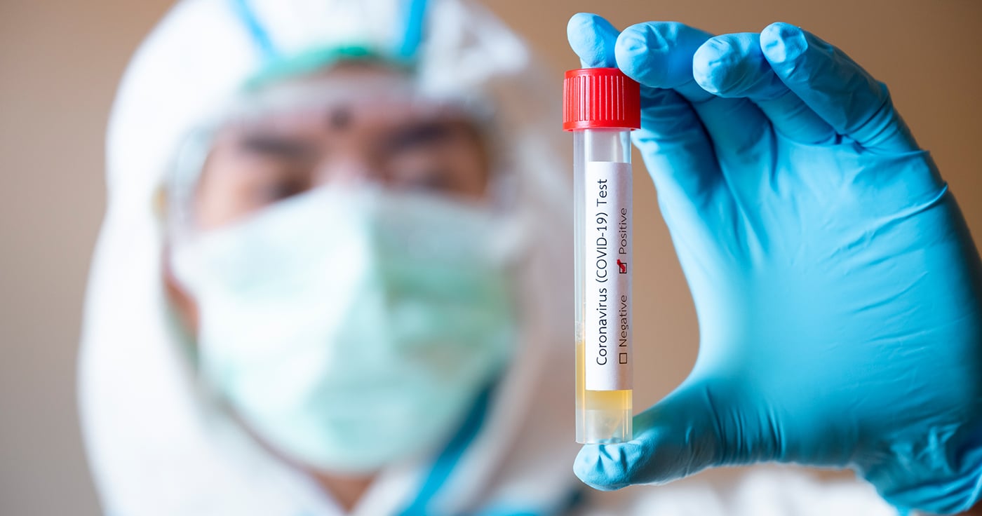 Schweiz bestätigt nicht, dass PCR-Tests Corona-Infektionen nicht nachweisen!
