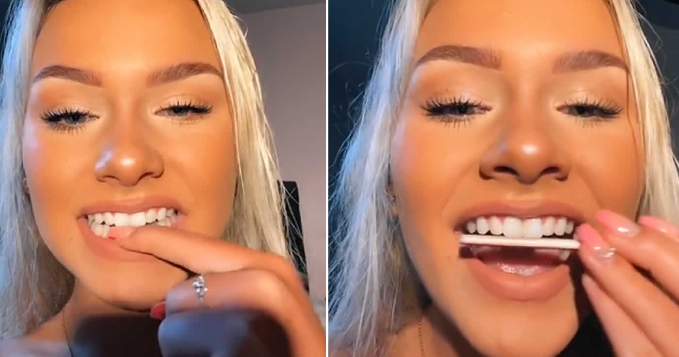 Schiefe Zähne ganz einfach selbst gerade bekommen – mit einer Nagelfeile?!