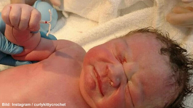 Kam ein Baby tatsächlich mit Spirale in der Hand zur Welt?